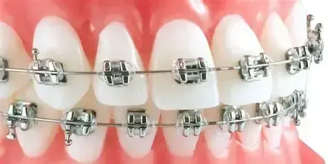 Orthodontie